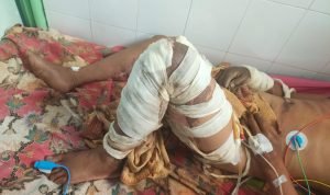 Korban Minyak Tanah Oplosan 2